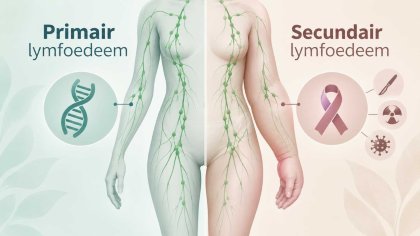 Oorzakaen lymfoedeem